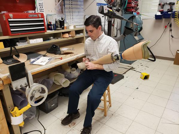 Andy Steele, Mason City Prosthetics, Above the knee prosthetic Mason City